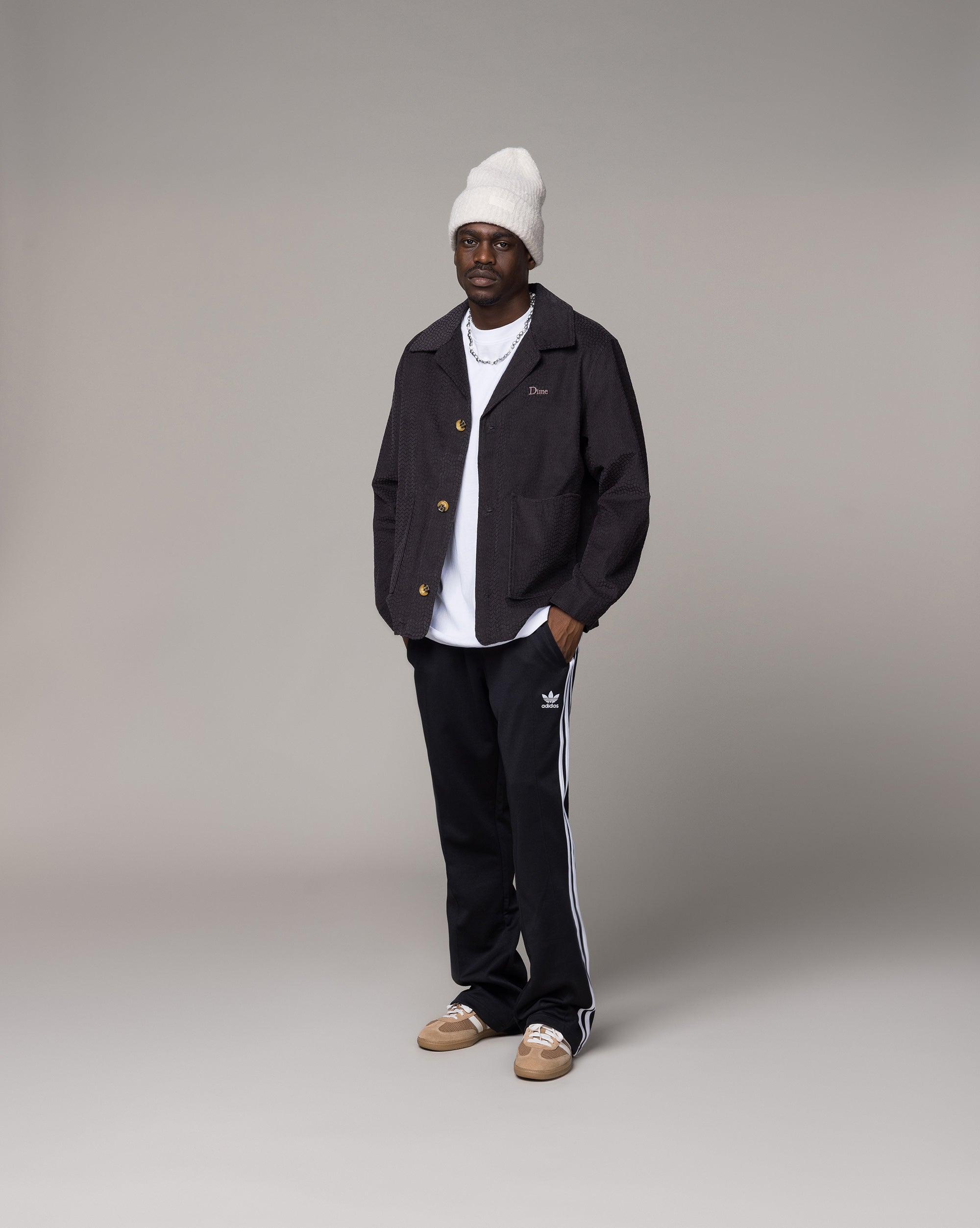 Image of Dime Printed Cord Jacket